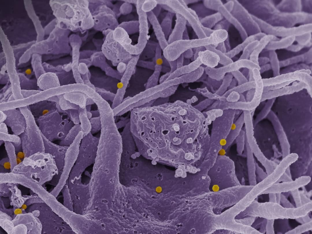 Exploring Fungi, Bacteria & Protozoa in Brown County