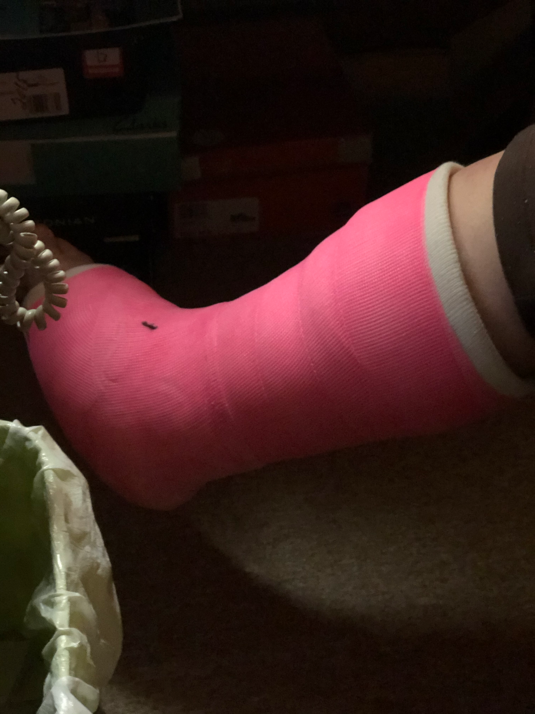 Broken Leg From Hiking in Brown County, Indana